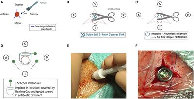The Minimally Invasive Star-Shaped Incision Technique and the Linear Incision Technique With Tissue Preservation for Percutaneous Bone Conduction Devices: A Retrospective Cohort Study